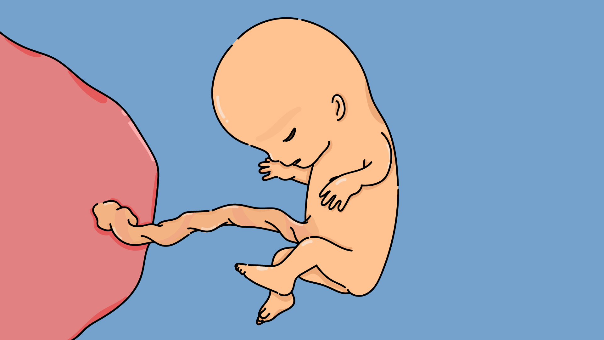Foetus onzième semaine de grossesse